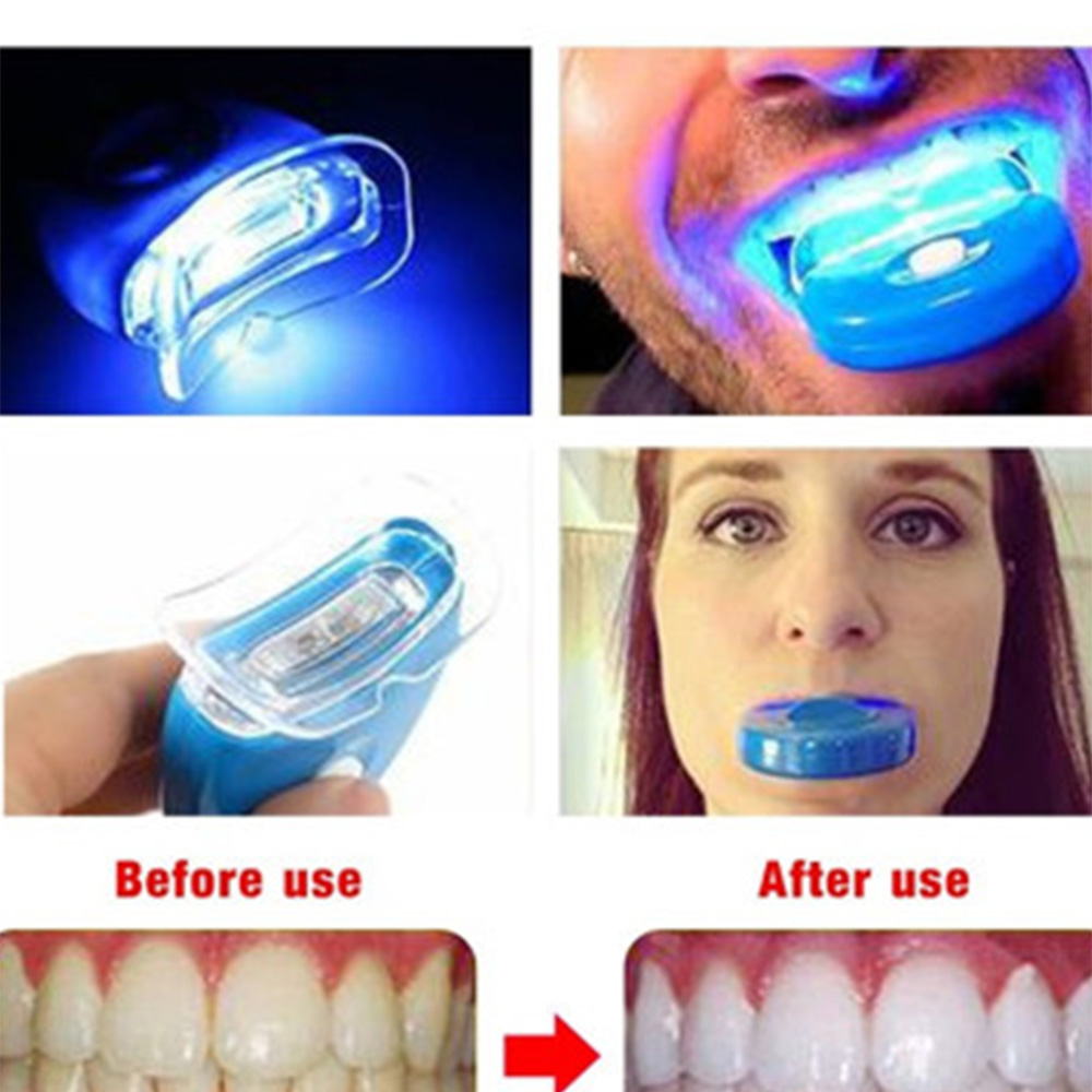 LED Teeth Whitening Light Whit - đánh giá và giá Teeth Whitening Laser Treatment