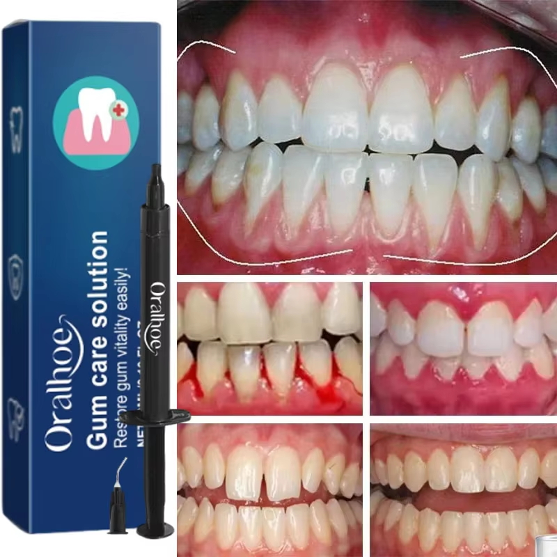 Teeth Whitening Gel Gum Repair - đánh giá và giá Teeth Whitening Gels