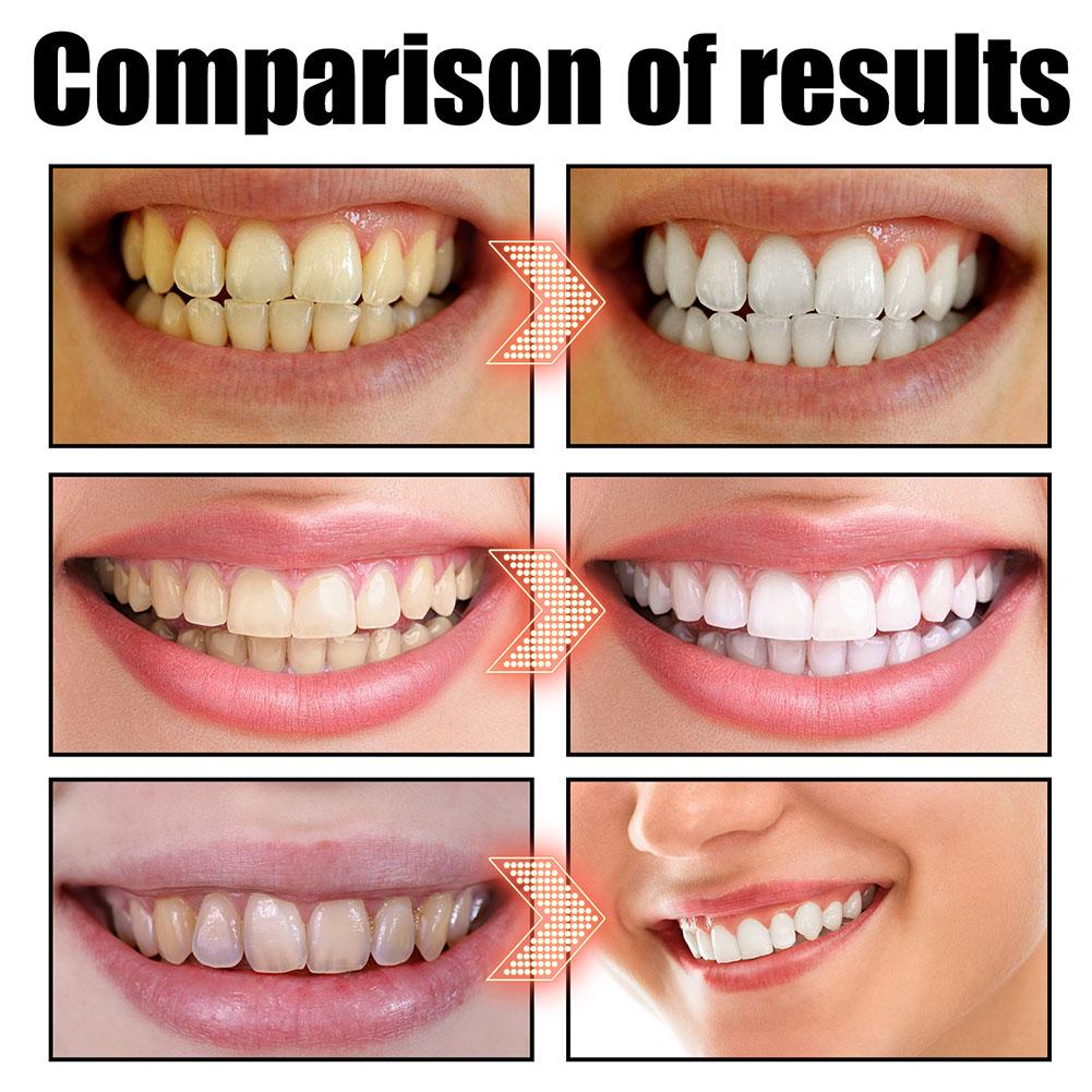 Coconut Mint Pulling Oil Mouth - đánh giá và giá Teeth Whitening Oil Pulling