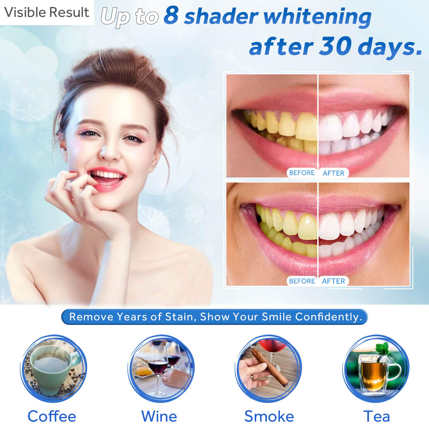 Teeth Whitening Gel Refill Syr - đánh giá và giá Teeth Whitening Singapore