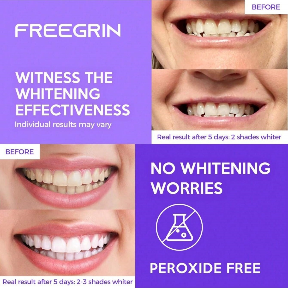 Deluxe Whitening Teeth Sticker - đánh giá và giá Teeth Whitening Singapore