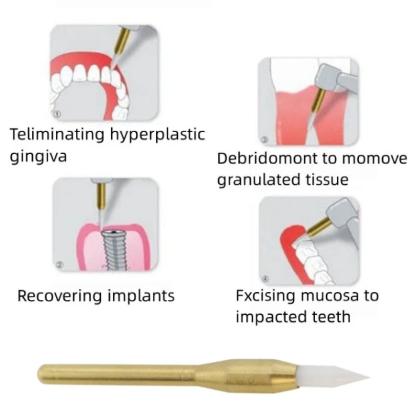 Dental Soft Trimmer Burs Surgi - đánh giá và giá Teeth Whitening Express